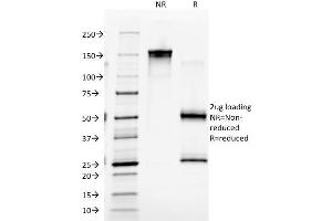 SDS-PAGE Analysis Purified Macrophage Monoclonal Antibody (D11). (Macrophage / Histiocytoma Marker Antikörper)