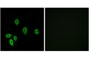 Immunofluorescence analysis of A549 cells, using TRHR Antibody.