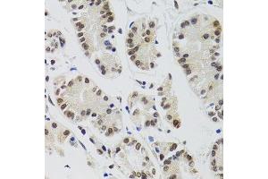 Immunohistochemistry (Paraffin-embedded Sections) (IHC (p)) image for anti-Endothelial Differentiation Related Factor 1 (EDF1) (AA 1-148) antibody (ABIN1679646)