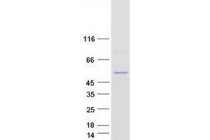 UGT2B10 Protein (Transcript Variant 1) (Myc-DYKDDDDK Tag)