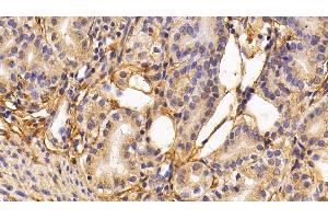 Immunohistochemistry (IHC) image for anti-Procollagen III N-Terminal Propeptide (PIIINP) antibody (ABIN7427888)