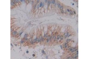 Used in DAB staining on fromalin fixed paraffin- embedded Kidney tissue (MUC3B Antikörper  (AA 836-931))
