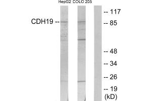 Western blot analysis of extracts from HepG2 cells and COLO205 cells, using CDH19 antibody. (CDH19 Antikörper  (Internal Region))