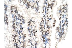 RUNDC2A antibody was used for immunohistochemistry at a concentration of 4-8 ug/ml to stain Epithelial cells of intestinal villus (arrows) in Human Intestine. (SNX29 Antikörper  (N-Term))