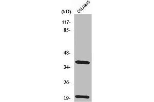 Western Blot analysis of COLO205 cells using TCR β Polyclonal Antibody (TRBC1 Antikörper  (Internal Region))