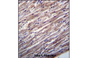 RASD1 Antibody (C-term) (ABIN657026 and ABIN2846202) immunohistochemistry analysis in formalin fixed and paraffin embedded human heart tissue followed by peroxidase conjugation of the secondary antibody and DAB staining. (RASD1 Antikörper  (C-Term))