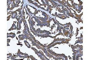 IHC analysis of TRMT61B using anti-TRMT61B antibody (ABIN7602334). (TRMT61B Antikörper  (AA 7-477))
