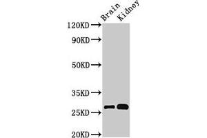 Western Blot Positive WB detected in: Mouse brain tissue, Mouse kidney tissue All lanes: OLFML2B antibody at 3 μg/mL Secondary Goat polyclonal to rabbit IgG at 1/50000 dilution Predicted band size: 84, 28 kDa Observed band size: 28 kDa (OLFML2B Antikörper  (AA 451-750))