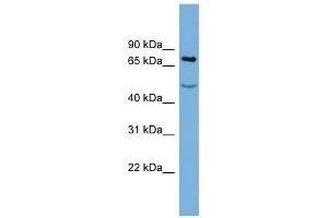 STIM1 antibody used at 1 ug/ml to detect target protein. (STIM1 Antikörper  (Middle Region))