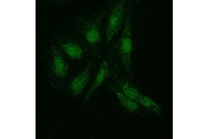 IF analysis of KI/VIRMA using anti-KI/VIRMA antibody (ABIN7599707). (Protein Virilizer Homolog (VIRMA) (AA 11-1529) Antikörper)