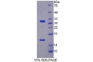 SDS-PAGE (SDS) image for Sirtuin 3 (SIRT3) (AA 5-257) protein (His tag) (ABIN2126796)