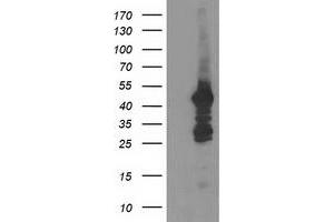 HEK293T cells were transfected with the pCMV6-ENTRY control (Left lane) or pCMV6-ENTRY DOK2 (Right lane) cDNA for 48 hrs and lysed. (DOK2 Antikörper)