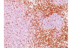 Formalin-fixed, paraffin-embedded human Tonsil (10X) stained with CD6 Monoclonal Antibody (3F7B5). (CD6 Antikörper)