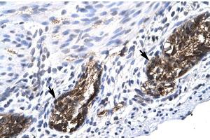 Human Stomach (E2F4 Antikörper  (C-Term))