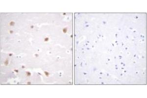 Immunohistochemistry analysis of paraffin-embedded human brain tissue, using CKII-beta (Ab-209) Antibody. (CSNK2B Antikörper  (AA 166-215))