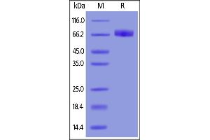 Human IL-4 R alpha, Fc Tag on  under reducing (R) condition. (IL4 Receptor Protein (AA 26-232) (Fc Tag))