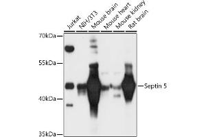 Western blot analysis of extracts of various cell lines, using Septin 5 antibody (ABIN6128759, ABIN6147556, ABIN6147557 and ABIN6216776) at 1:3000 dilution. (Septin 5 Antikörper  (AA 1-369))