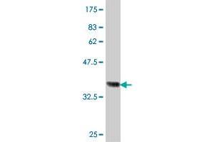 Western Blot detection against Immunogen (37 KDa) . (GALNT2 Antikörper  (AA 473-571))