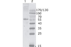 Western Blot testing of HIV-1 Gag p17/24 using HIV-1 p24 antibody, clone 2N32 (05-009). (HIV-1 p24 Antikörper  (AA 80-90))