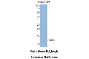 Western Blotting (WB) image for anti-Placenta-Specific 9 (PLAC9) (AA 23-97) antibody (ABIN1078445) (PLAC9 Antikörper  (AA 23-97))