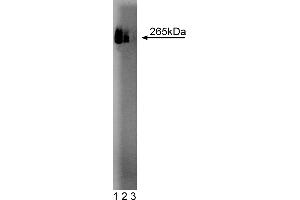 Western Blotting (WB) image for anti-Fatty Acid Synthase (FASN) (AA 9-202) antibody (ABIN968279)
