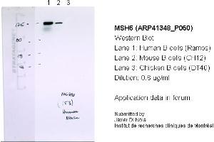 Western Blotting (WB) image for anti-MutS Homolog 6 (E. Coli) (MSH6) (N-Term) antibody (ABIN2776759) (MSH6 Antikörper  (N-Term))