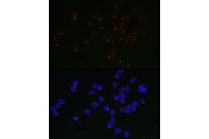 Immunofluorescence analysis of Jurkat cells using  / ARP Rabbit mAb (ABIN7265490) at dilution of 1:50 (40x lens). (ARFRP1 Antikörper)
