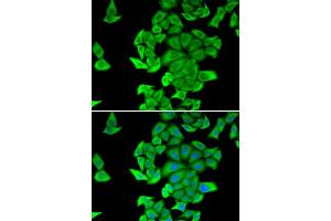 Immunofluorescence analysis of HeLa cells using SMYD2 antibody (ABIN5973871).