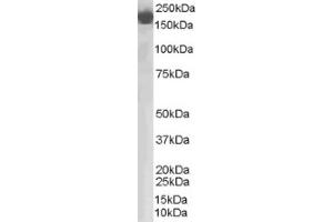 Image no. 1 for anti-Complement Factor H (CFH) (Internal Region) antibody (ABIN374588)