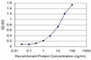 Detection limit for recombinant GST tagged FOXQ1 is approximately 0. (FOXQ1 Antikörper  (AA 110-219))