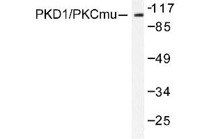 Image no. 1 for anti-Protein Kinase D1 (PRKD1) antibody (ABIN272067) (PKC mu Antikörper)