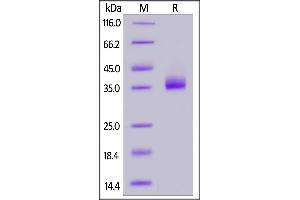 Biotinylated SARS-CoV-2 Spike RBD, His,Avitag (B.