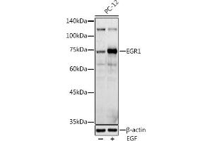 Western blot analysis of extracts of PC-12 cells, using EGR1 antibody (ABIN6133683, ABIN6139992, ABIN7101807 and ABIN7101808) at 1:1000 dilution.