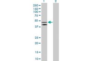 Western Blot analysis of HOMER1 expression in transfected 293T cell line by HOMER1 MaxPab polyclonal antibody. (HOMER1 Antikörper  (AA 1-354))