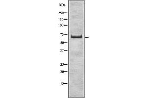 Western blot analysis of ZSCAN2 expression in HEK293 cells ,The lane on the left is treated with the antigen-specific peptide. (ZSCAN2 Antikörper  (Internal Region))
