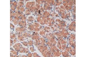 IHC-P analysis of stomach tissue, with DAB staining. (TEP1 Antikörper  (AA 2368-2627))