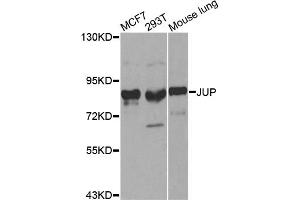 Western blot analysis of extracts of various cell lines, using JUP antibody. (JUP Antikörper)