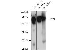Western blot analysis of extracts of various cell lines, using PLVAP antibody (ABIN7269386) at 1:1000 dilution. (PLVAP Antikörper  (AA 63-442))