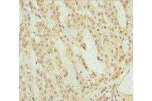 Immunohistochemistry of paraffin-embedded human adrenal gland tissue using ABIN7158523 at dilution of 1:100 (ACSL6 Antikörper  (AA 458-697))