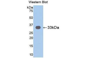 Detection of Recombinant IL31RA, Human using Polyclonal Antibody to Interleukin 31 Receptor A (IL31RA) (IL31RA Antikörper  (AA 205-456))