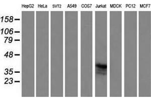 Western Blotting (WB) image for anti-T-cell surface glycoprotein CD1c (CD1C) antibody (ABIN2670659) (CD1c Antikörper)