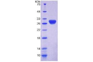 SDS-PAGE analysis of Mouse RTBDN Protein. (Retbindin Protein (RTBDN))