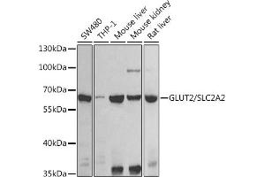 Western blot analysis of extracts of various cell lines, using GLUT2/GLUT2/SLC2 antibody (ABIN6134110, ABIN6147959, ABIN6147960 and ABIN6225170) at 1:1000 dilution. (SLC2A2 Antikörper  (AA 1-100))