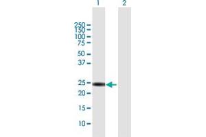 Western Blot analysis of KIF26A expression in transfected 293T cell line by KIF26A MaxPab polyclonal antibody. (KIF26A Antikörper  (AA 1-203))