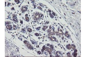 Immunohistochemical staining of paraffin-embedded Human breast tissue using anti-APP mouse monoclonal antibody. (APP Antikörper)