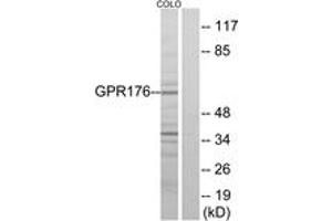 Western blot analysis of extracts from COLO205 cells, using GPR176 Antibody. (GPR176 Antikörper  (AA 466-515))