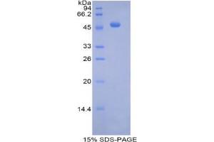 SDS-PAGE analysis of Mouse Pregnane X Receptor Protein.