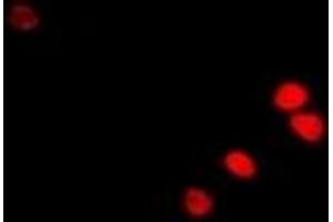 Immunofluorescent analysis of RAG-2 staining in U2OS cells. (RAG2 Antikörper)