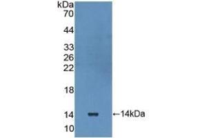 Detection of Recombinant IL10Ra, Human using Polyclonal Antibody to Interleukin 10 Receptor Alpha (IL10Ra) (IL-10RA Antikörper  (AA 132-235))