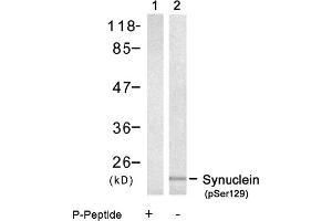 Image no. 1 for anti-Synuclein, alpha (SNCA) (pSer129) antibody (ABIN319235) (SNCA Antikörper  (pSer129))